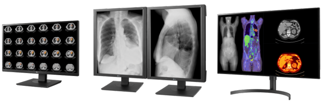 LG Monitors